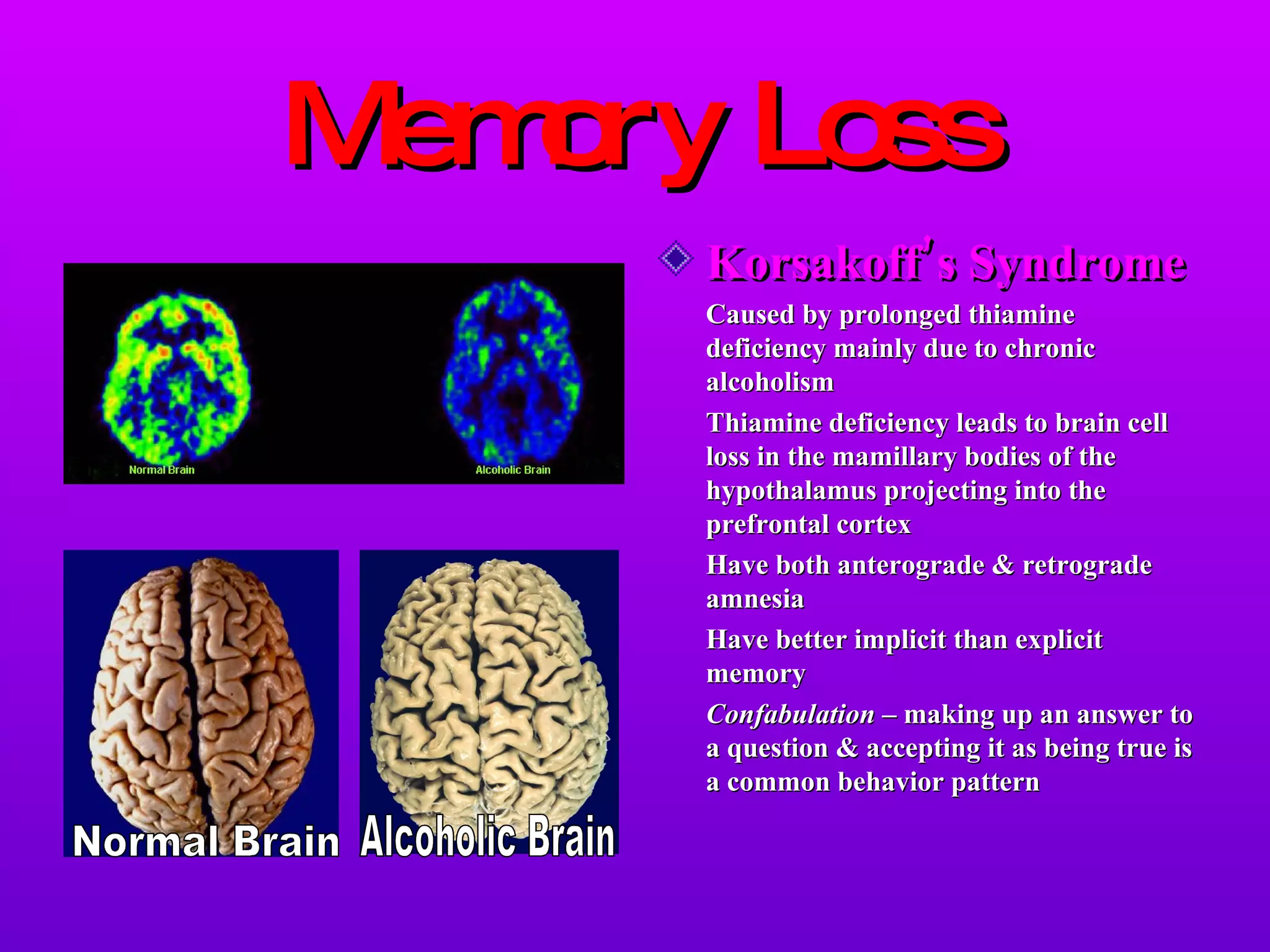 Memory Loss Korsakoff’s Syndrome Caused by prolonged thiamine deficiency mainly due to chronic alcoholism Thiamine deficiency leads to brain cell loss in the mamillary bodies of the hypothalamus projecting into the prefrontal cortex Have both anterograde & retrograde amnesia Have better implicit than explicit memory Confabulation –  making up an answer to a question & accepting it as being true is a common behavior pattern Normal Brain Alcoholic Brain 