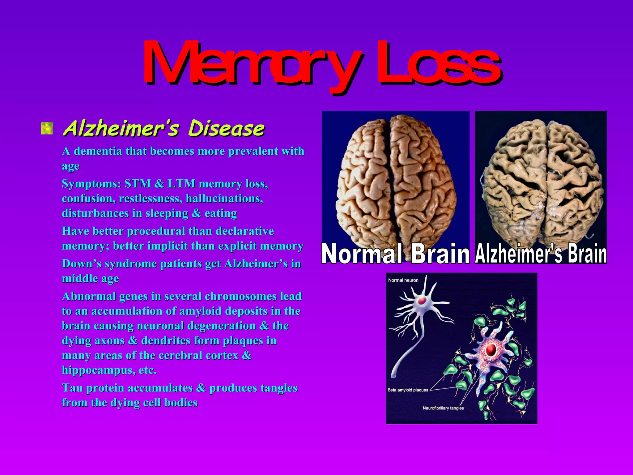 Memory Loss Alzheimer’s Disease A dementia that becomes more prevalent with age Symptoms: STM & LTM memory loss, confusion, restlessness, hallucinations, disturbances in sleeping & eating Have better procedural than declarative memory; better implicit than explicit memory Down’s syndrome patients get Alzheimer’s in middle age Abnormal genes in several chromosomes lead to an accumulation of amyloid deposits in the brain causing neuronal degeneration & the dying axons & dendrites form plaques in many areas of the cerebral cortex & hippocampus, etc. Tau protein accumulates & produces tangles from the dying cell bodies Normal Brain Alzheimer's Brain 