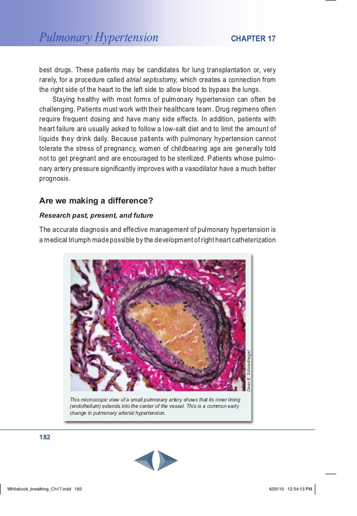 Pulmonary Hypertension