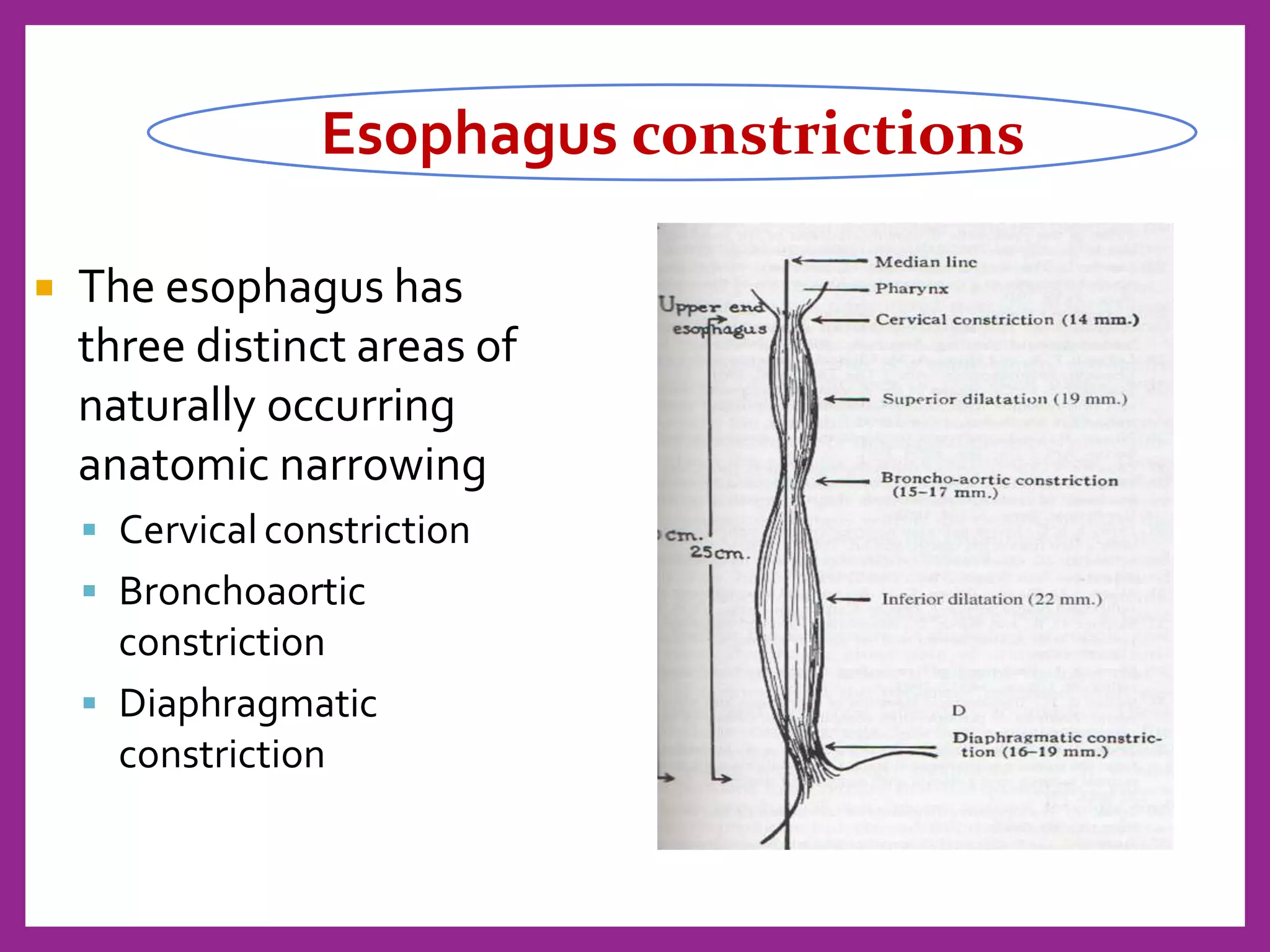  The esophagus has
three distinct areas of
naturally occurring
anatomic narrowing
 Cervical constriction
 Bronchoaortic
constriction
 Diaphragmatic
constriction
Esophagus constrictions
 