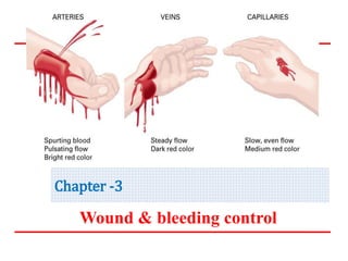 Chapter -3
Wound & bleeding control
 