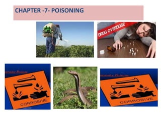 CHAPTER -7- POISONING
 