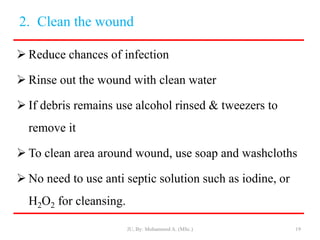 2. Clean the wound
 Reduce chances of infection
 Rinse out the wound with clean water
 If debris remains use alcohol rinsed & tweezers to
remove it
 To clean area around wound, use soap and washcloths
 No need to use anti septic solution such as iodine, or
H2O2 for cleansing.
JU, By: Mohammed A. (MSc.) 19
 