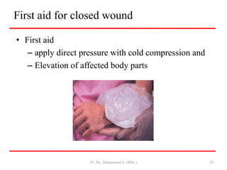 First aid for closed wound
• First aid
– apply direct pressure with cold compression and
– Elevation of affected body parts
JU, By: Mohammed A. (MSc.) 25
 