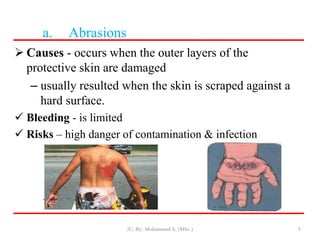 a. Abrasions
 Causes - occurs when the outer layers of the
protective skin are damaged
– usually resulted when the skin is scraped against a
hard surface.
 Bleeding - is limited
 Risks – high danger of contamination & infection
JU, By: Mohammed A. (MSc.) 5
 