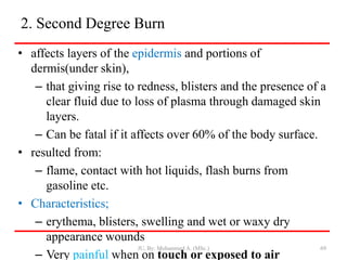 2. Second Degree Burn
• affects layers of the epidermis and portions of
dermis(under skin),
– that giving rise to redness, blisters and the presence of a
clear fluid due to loss of plasma through damaged skin
layers.
– Can be fatal if it affects over 60% of the body surface.
• resulted from:
– flame, contact with hot liquids, flash burns from
gasoline etc.
• Characteristics;
– erythema, blisters, swelling and wet or waxy dry
appearance wounds
– Very painful when on touch or exposed to air
JU, By: Mohammed A. (MSc.) 69
 