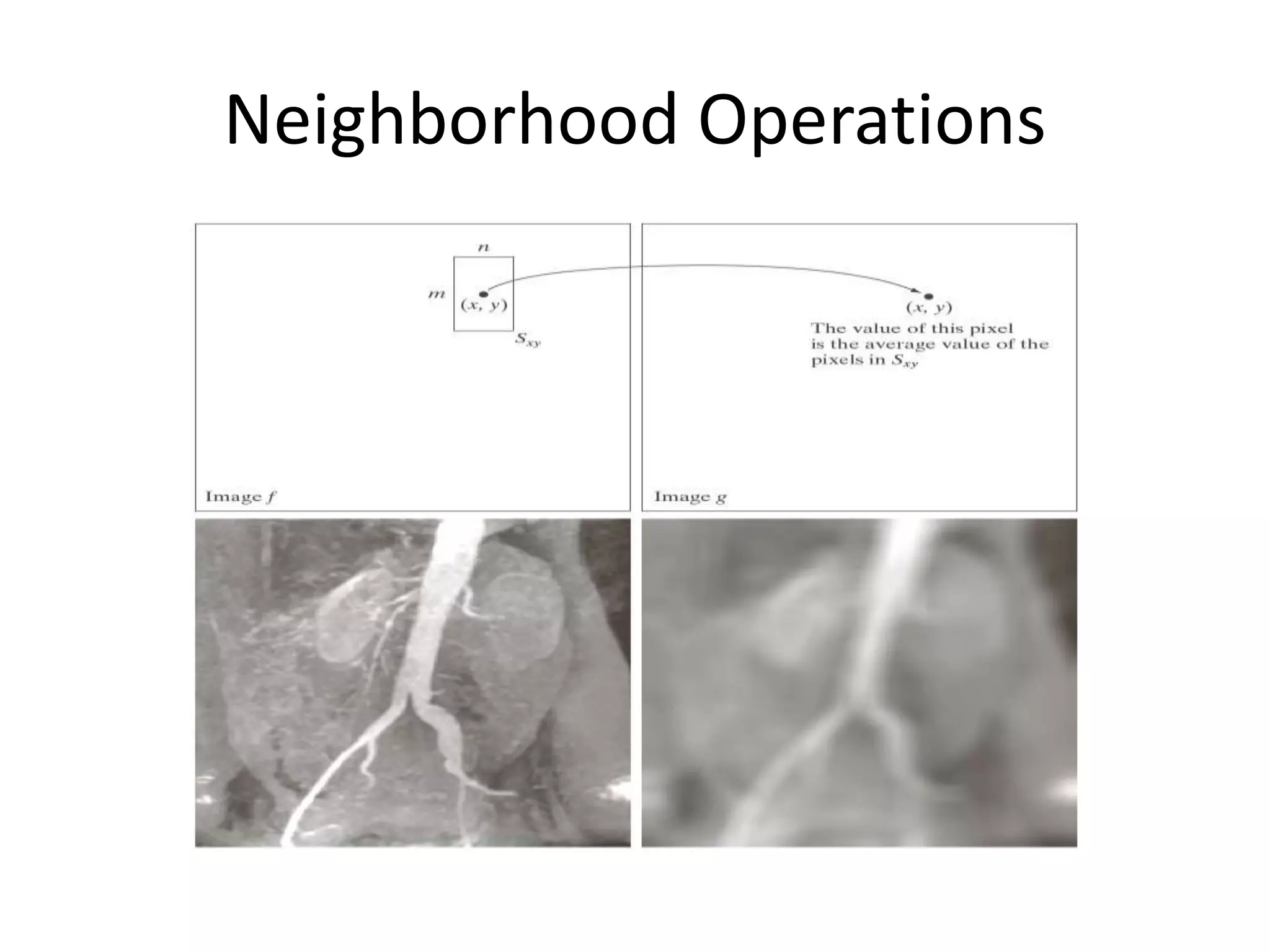 Neighborhood Operations
 