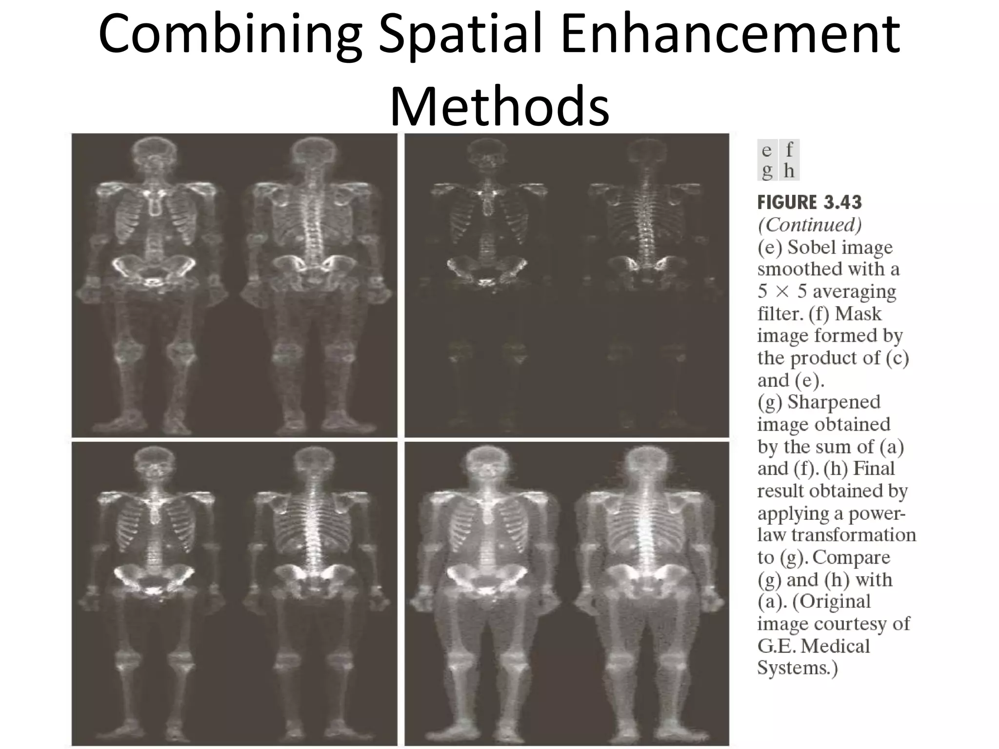 Combining Spatial Enhancement
Methods
 