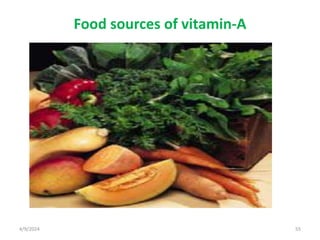 Food sources of vitamin-A
55
4/9/2024
 