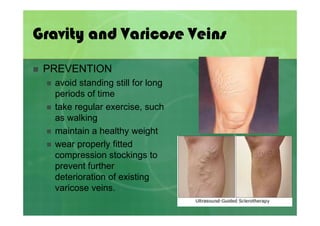 Forces and Newton\'s Laws