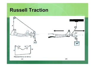 Forces and Newton\'s Laws