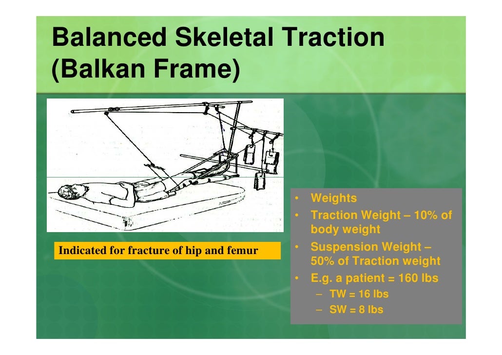 What is balanced suspension traction?