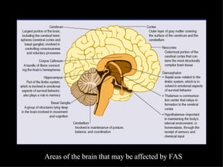 Areas of the brain that may be affected by FAS 