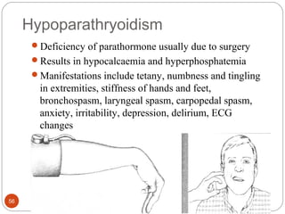 Hypoparathryoidism
Deficiency of parathormone usually due to surgery
Results in hypocalcaemia and hyperphosphatemia
Manifestations include tetany, numbness and tingling
in extremities, stiffness of hands and feet,
bronchospasm, laryngeal spasm, carpopedal spasm,
anxiety, irritability, depression, delirium, ECG
changes
Trousseau’s sign and Chvostek’s sign
56
 