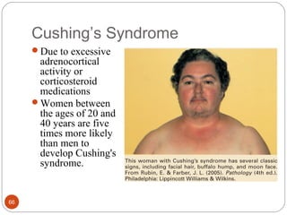 Cushing’s Syndrome
Due to excessive
adrenocortical
activity or
corticosteroid
medications
Women between
the ages of 20 and
40 years are five
times more likely
than men to
develop Cushing's
syndrome.
66
 
