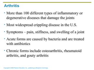 Arthritis More than 100 different types of inflammatory or degenerative diseases that damage the joints Most widespread crippling disease in the U.S. Symptoms – pain, stiffness, and swelling of a joint Acute forms are caused by bacteria and are treated with antibiotics Chronic forms include osteoarthritis, rheumatoid arthritis, and gouty arthritis 