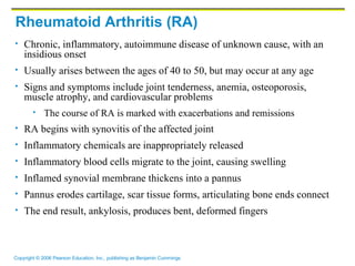 Rheumatoid Arthritis (RA) Chronic, inflammatory, autoimmune disease of unknown cause, with an insidious onset Usually arises between the ages of 40 to 50, but may occur at any age Signs and symptoms include joint tenderness, anemia, osteoporosis, muscle atrophy, and cardiovascular problems The course of RA is marked with exacerbations and remissions RA begins with synovitis of the affected joint Inflammatory chemicals are inappropriately released Inflammatory blood cells migrate to the joint, causing swelling Inflamed synovial membrane thickens into a pannus Pannus erodes cartilage, scar tissue forms, articulating bone ends connect The end result, ankylosis, produces bent, deformed fingers 