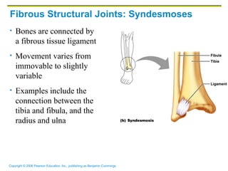 Fibrous Structural Joints: Syndesmoses Bones are connected by a fibrous tissue ligament Movement varies from immovable to slightly variable Examples include the connection between the tibia and fibula, and the radius and ulna 