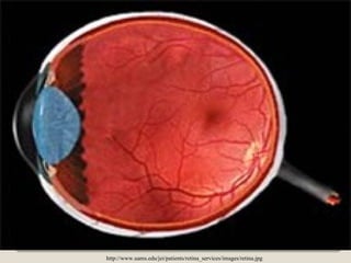 http://www.uams.edu/jei/patients/retina_services/images/retina.jpg
 