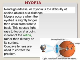 Nearsightedness, or myopia is the difficulty of
seeing objects at a distance.
Myopia occurs when the
eyeball is slightly longer
than usual from front to
back. This causes light
rays to focus at a point
in front of the retina,
rather than directly on
its surface.
Concave lenses are
used to correct the
problem.
MYOPIA
 