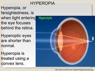 Hyperopia, or
farsightedness, is
when light entering
the eye focuses
behind the retina.
Hyperoptic eyes
are shorter than
normal.
Hyperopia is
treated using a
convex lens.
http://web.mountain.net/~topeye/images/hyperopia.jpg
HYPEROPIA
 