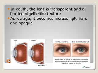 CataractsCataracts
In youth, the lens is transparent and a
hardened jelly-like texture
As we age, it becomes increasingly hard
and opaque
 
