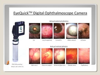 Anatomy of the EyeAnatomy of the Eye
 
