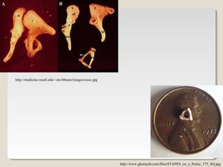 http://www.ghorayeb.com/files/STAPES_on_a_Penny_375_SQ.jpg
http://medicine.wustl.edu/~oto/bbears/images/ossic.jpg
 