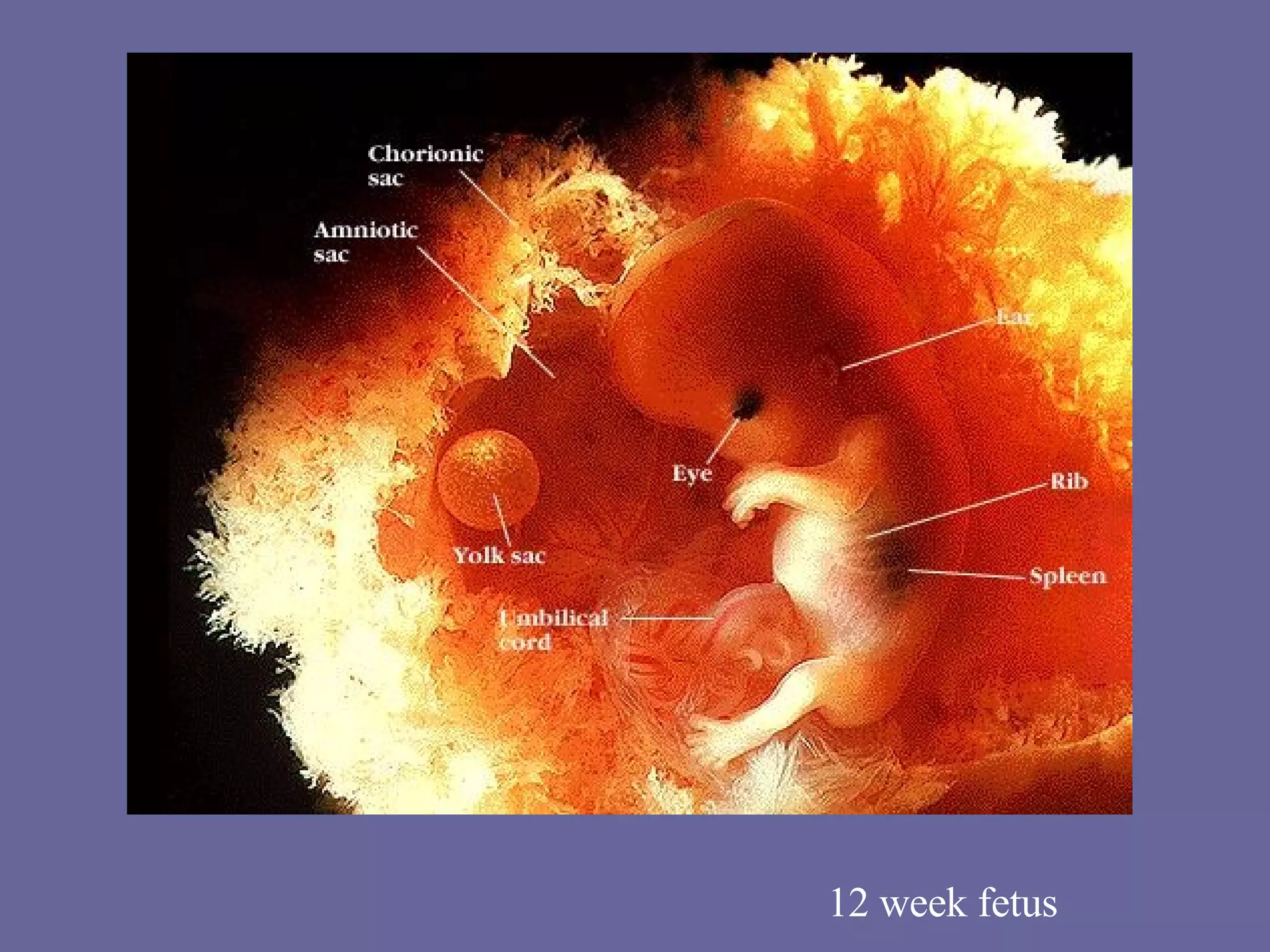 12 week fetus 