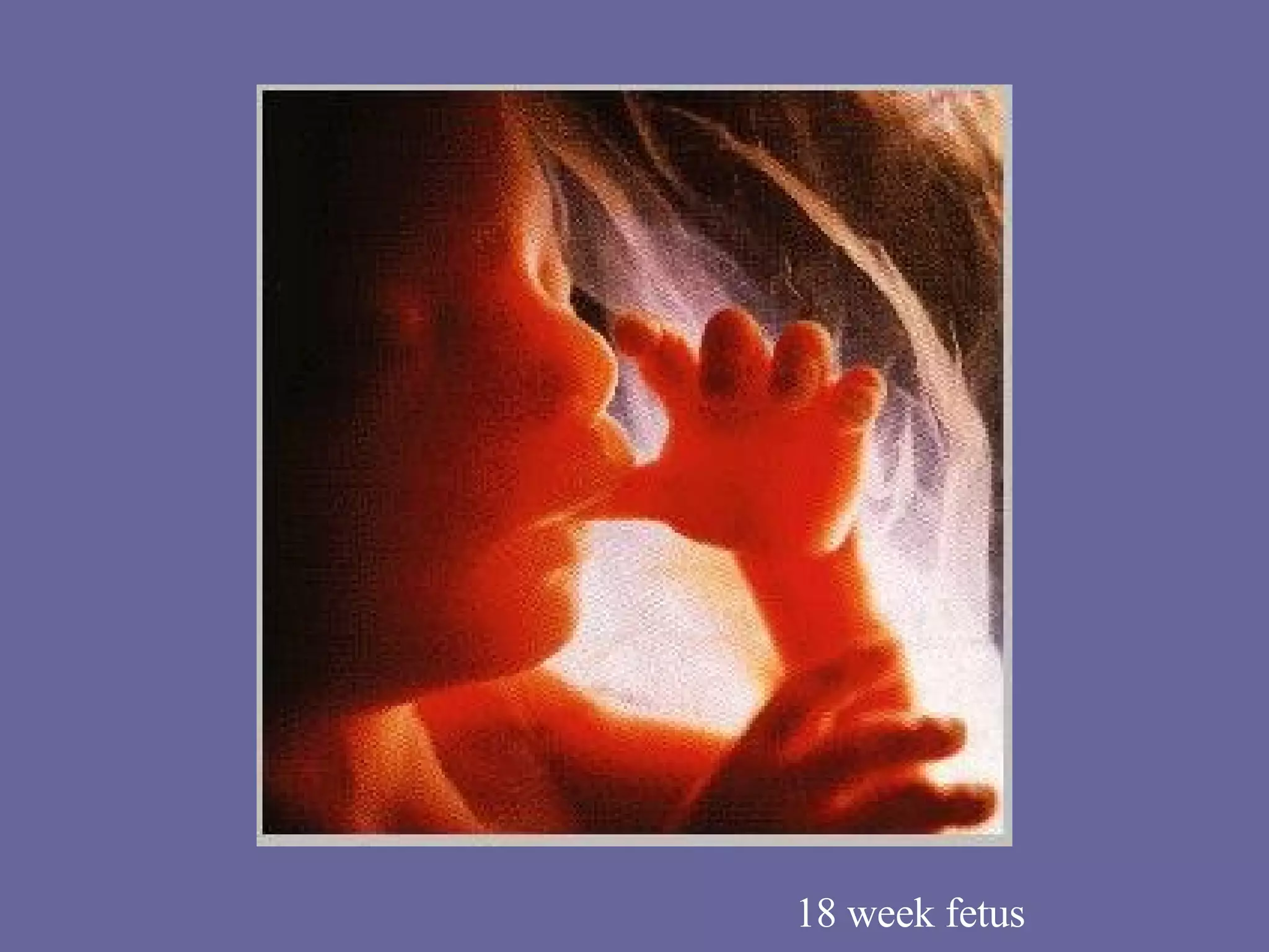 18 week fetus 