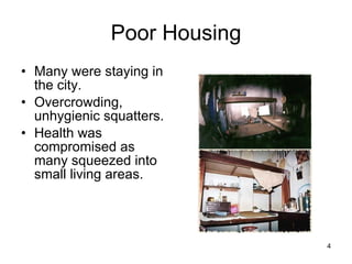Poor Housing Many were staying in the city. Overcrowding, unhygienic squatters. Health was compromised as many squeezed into small living areas. 