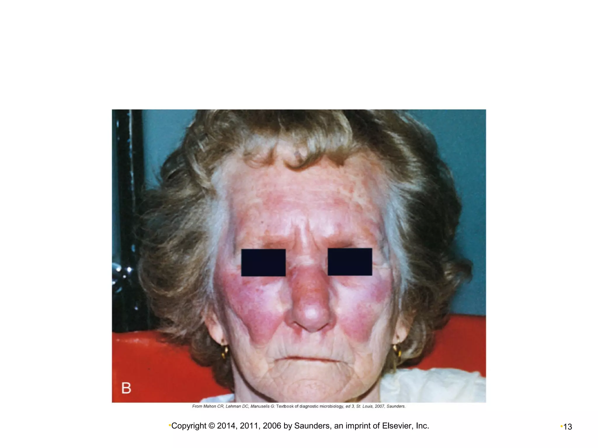 •Copyright © 2014, 2011, 2006 by Saunders, an imprint of Elsevier, Inc. •13 
 