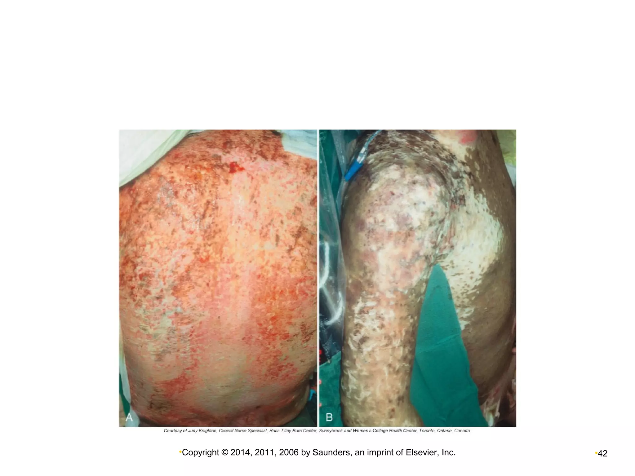 •Copyright © 2014, 2011, 2006 by Saunders, an imprint of Elsevier, Inc. •42 
 