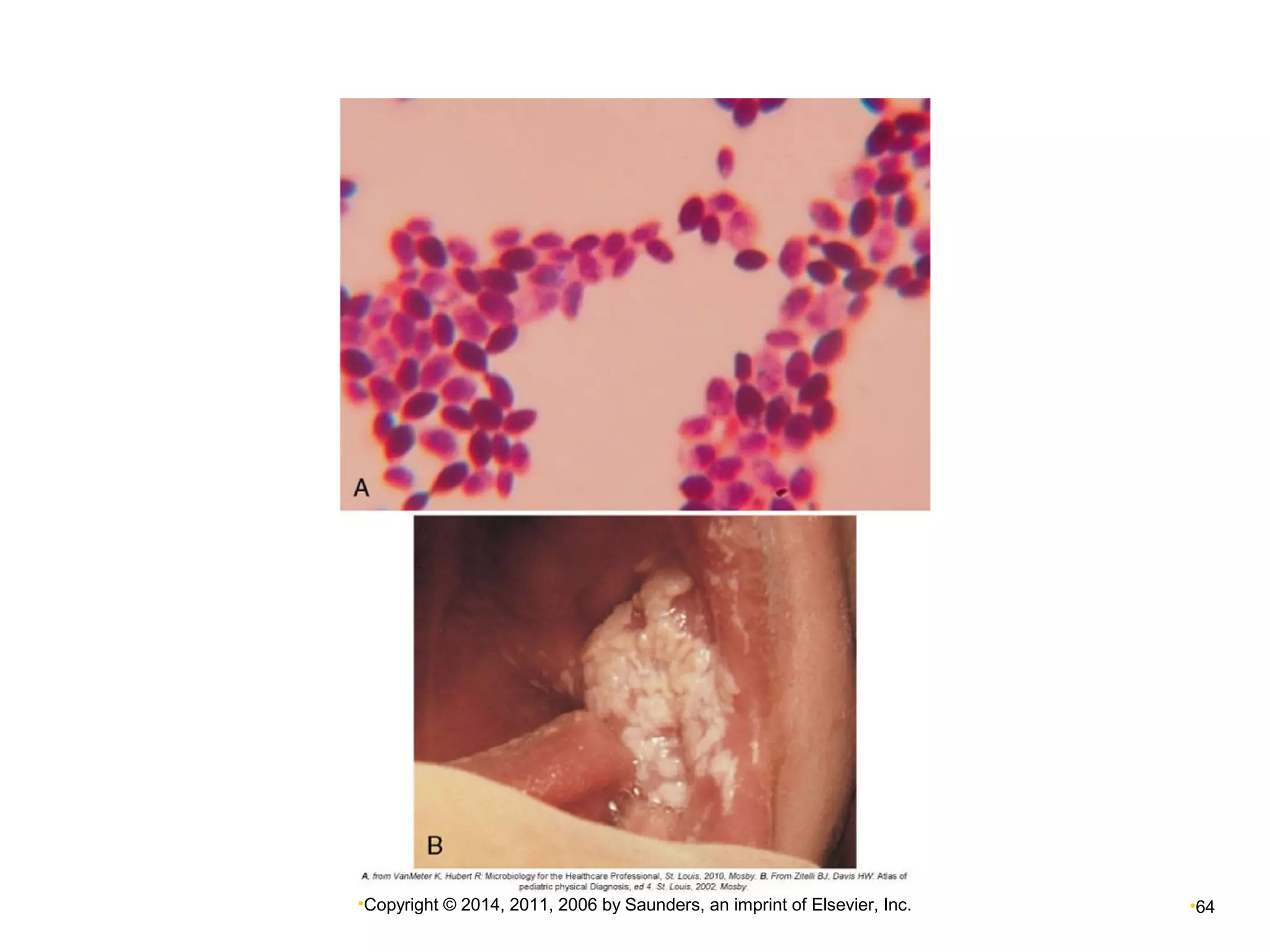 •Copyright © 2014, 2011, 2006 by Saunders, an imprint of Elsevier, Inc. •64 
 