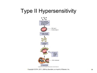 Type II Hypersensitivity 
•Copyright © 2014, 2011, 2006 by Saunders, an imprint of Elsevier, Inc. •36 
 
