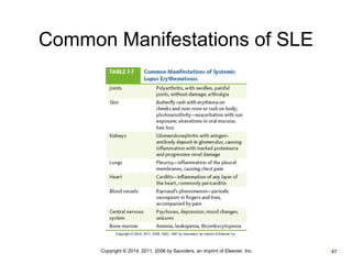 Common Manifestations of SLE 
•Copyright © 2014, 2011, 2006 by Saunders, an imprint of Elsevier, Inc. •47 
 