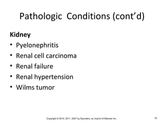 Copyright © 2014, 2011, 2007 by Saunders, an imprint of Elsevier Inc. 70
Pathologic Conditions (cont’d)
Kidney
• Pyelonephritis
• Renal cell carcinoma
• Renal failure
• Renal hypertension
• Wilms tumor
 