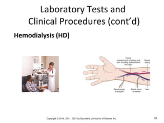 Copyright © 2014, 2011, 2007 by Saunders, an imprint of Elsevier Inc. 82
Laboratory Tests and
Clinical Procedures (cont’d)
Hemodialysis (HD)
 