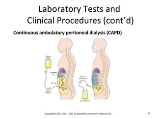 Copyright © 2014, 2011, 2007 by Saunders, an imprint of Elsevier Inc. 83
Laboratory Tests and
Clinical Procedures (cont’d)
Continuous ambulatory peritoneal dialysis (CAPD)
 