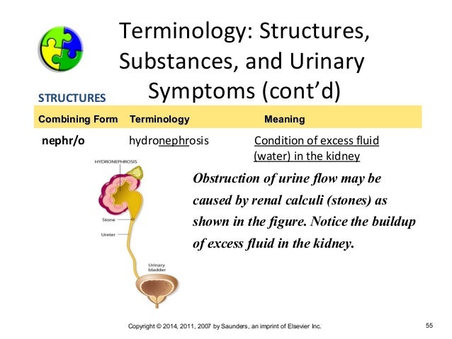 medical terminology chapter 7 the combining form for the tubes that move urine from the kidneys to the bladder is