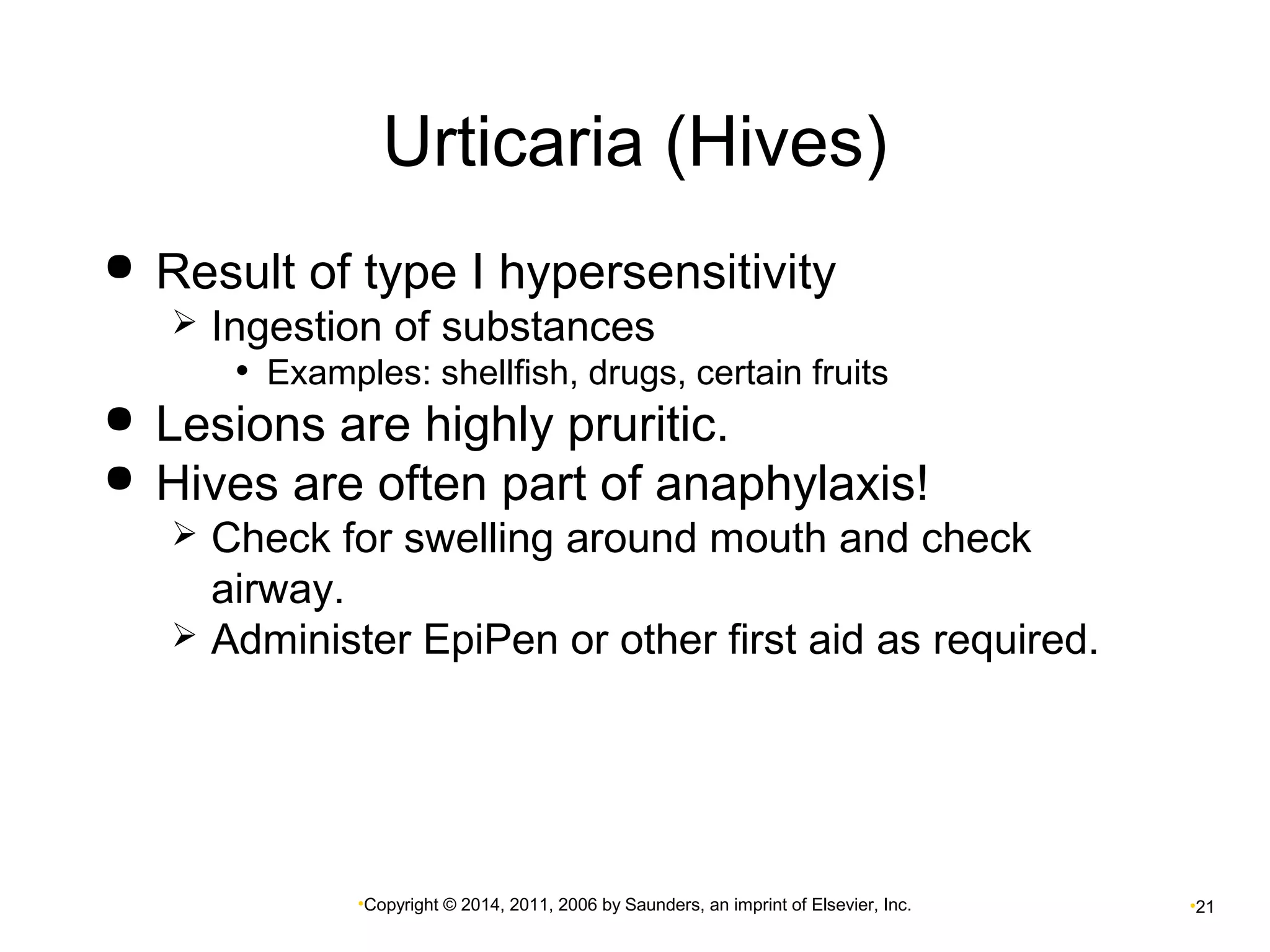Urticaria (Hives) 
 Result of type I hypersensitivity 
 Ingestion of substances 
• Examples: shellfish, drugs, certain fruits 
 Lesions are highly pruritic. 
 Hives are often part of anaphylaxis! 
 Check for swelling around mouth and check 
airway. 
 Administer EpiPen or other first aid as required. 
•Copyright © 2014, 2011, 2006 by Saunders, an imprint of Elsevier, Inc. •21 
 
