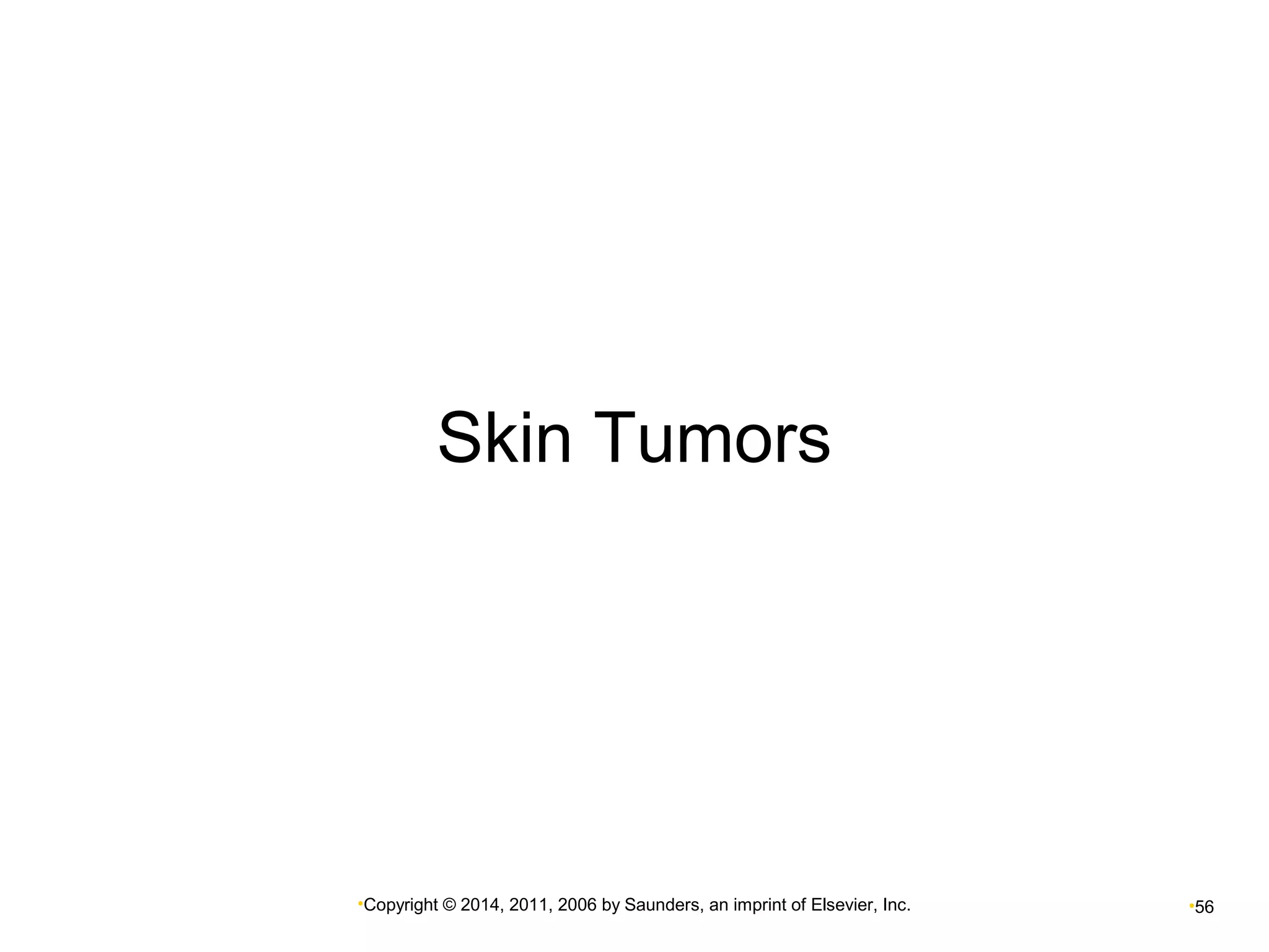 Skin Tumors 
•Copyright © 2014, 2011, 2006 by Saunders, an imprint of Elsevier, Inc. •56 
 