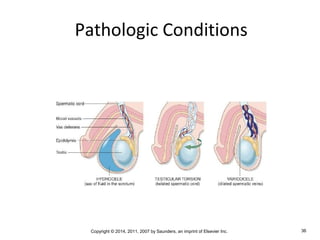 Copyright © 2014, 2011, 2007 by Saunders, an imprint of Elsevier Inc. 36
Pathologic Conditions
 