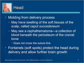 Head

• Molding from delivery process
      – May have swelling of the soft tissues of the
        scalp, called caput succedaneum
      – May see a cephalhematoma—a collection of
        blood beneath the periosteum of the cranial
        bone
            • Does not cross the suture line
• Fontanels (soft spots) protect the head during
  delivery and allow further brain growth

Elsevier items and derived items © 2011, 2007, 2006 by Saunders, an imprint of Elsevier Inc.   10
 