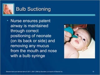 Bulb Suctioning

 • Nurse ensures patent
   airway is maintained
   through correct
   positioning of neonate
   (on its back or side) and
   removing any mucus
   from the mouth and nose
   with a bulb syringe


Elsevier items and derived items © 2011, 2007, 2006 by Saunders, an imprint of Elsevier Inc.   19
 