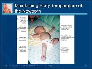 Maintaining Body Temperature of
                the Newborn




Elsevier items and derived items © 2011, 2007, 2006 by Saunders, an imprint of Elsevier Inc.   24
 