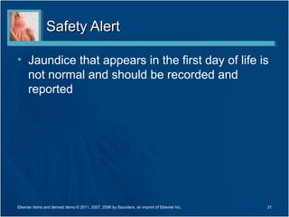 Safety Alert

• Jaundice that appears in the first day of life is
  not normal and should be recorded and
  reported




Elsevier items and derived items © 2011, 2007, 2006 by Saunders, an imprint of Elsevier Inc.   31
 