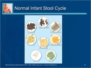 Normal Infant Stool Cycle




Elsevier items and derived items © 2011, 2007, 2006 by Saunders, an imprint of Elsevier Inc.   33
 