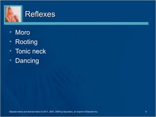 Reflexes

•     Moro
•     Rooting
•     Tonic neck
•     Dancing




Elsevier items and derived items © 2011, 2007, 2006 by Saunders, an imprint of Elsevier Inc.   9
 