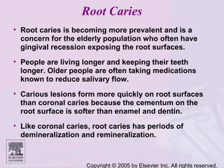 Copyright © 2005 by Elsevier Inc. All rights reserved.
Root Caries
• Root caries is becoming more prevalent and is a
concern for the elderly population who often have
gingival recession exposing the root surfaces.
• People are living longer and keeping their teeth
longer. Older people are often taking medications
known to reduce salivary flow.
• Carious lesions form more quickly on root surfaces
than coronal caries because the cementum on the
root surface is softer than enamel and dentin.
• Like coronal caries, root caries has periods of
demineralization and remineralization.
 